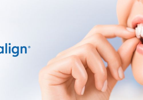 Dịch vụ niềng răng Invisalign và những lưu ý bạn cần biết