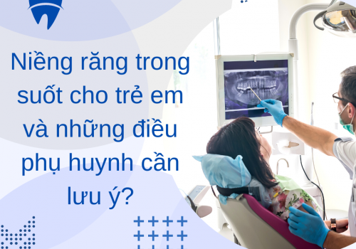 Niềng răng trong suốt cho trẻ em và những điều phụ huynh cần lưu ý?