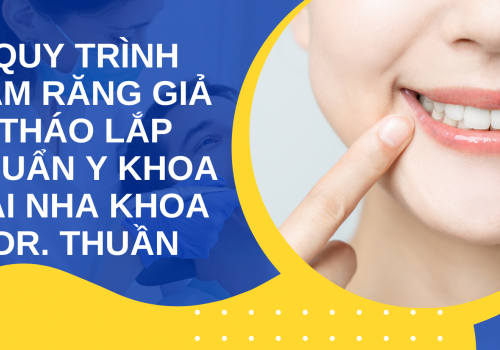 Quy trình làm răng giả tháo lắp chuẩn y khoa tại Nha khoa Dr. Thuần