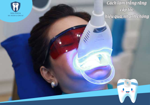 Gợi ý những cách làm trắng răng cấp tốc hiệu quả bạn nên thử