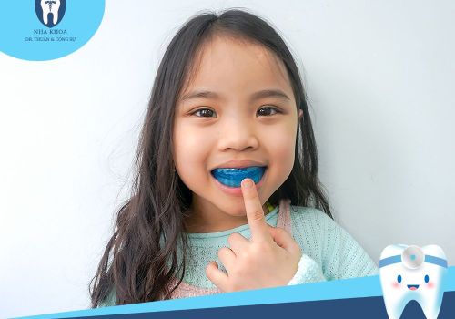 Niềng răng silicon trainer cho bé là gì? Có bao nhiêu loại?