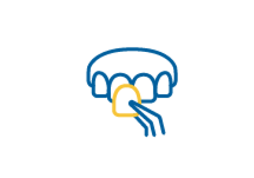 Niềng răng Invisalign