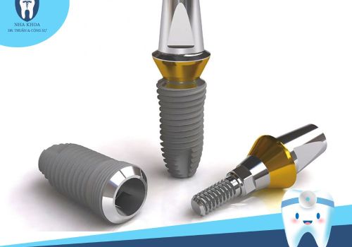 Tìm hiểu nguồn gốc trụ Implant Dentium Hàn Quốc và ưu nhược điểm