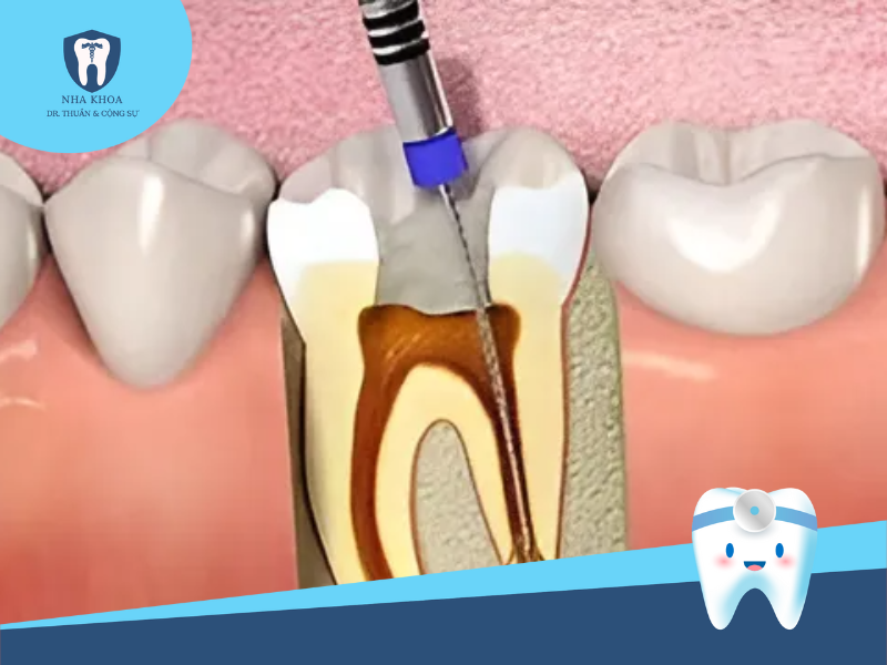 Phương pháp cấy tủy nhân tạo