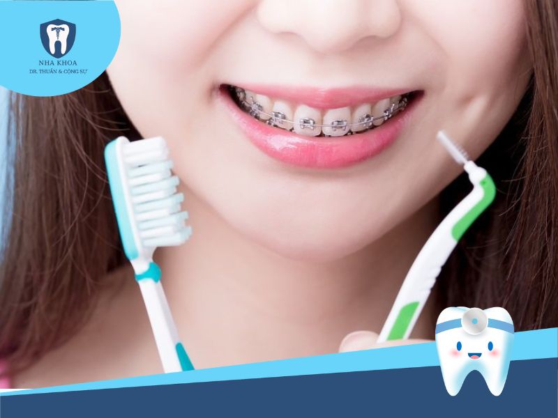 cách chăm sóc răng miệng khi niềng răng cho trẻ 8 tuổi