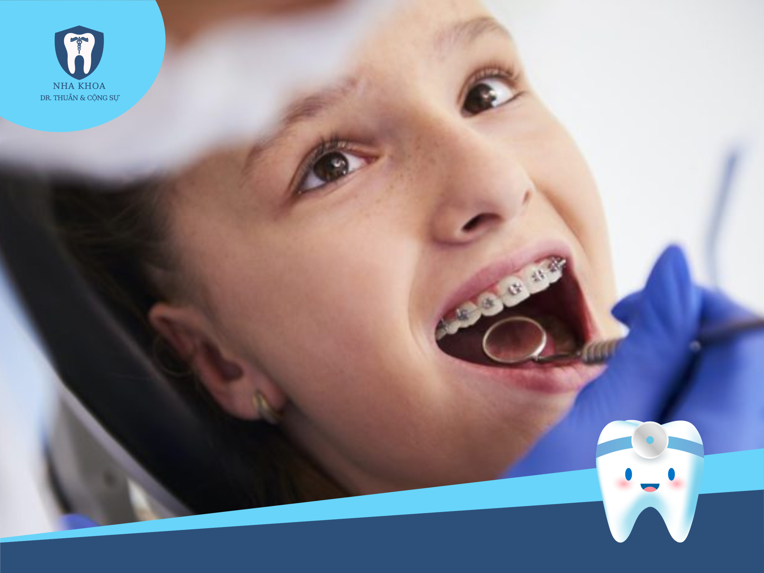 mac-cai-tu-buoc-va-mac-cai-thuong-2